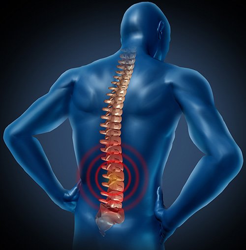 Lumbar & Spine Relief - Acute & Chronic Pain and Spine Center ...